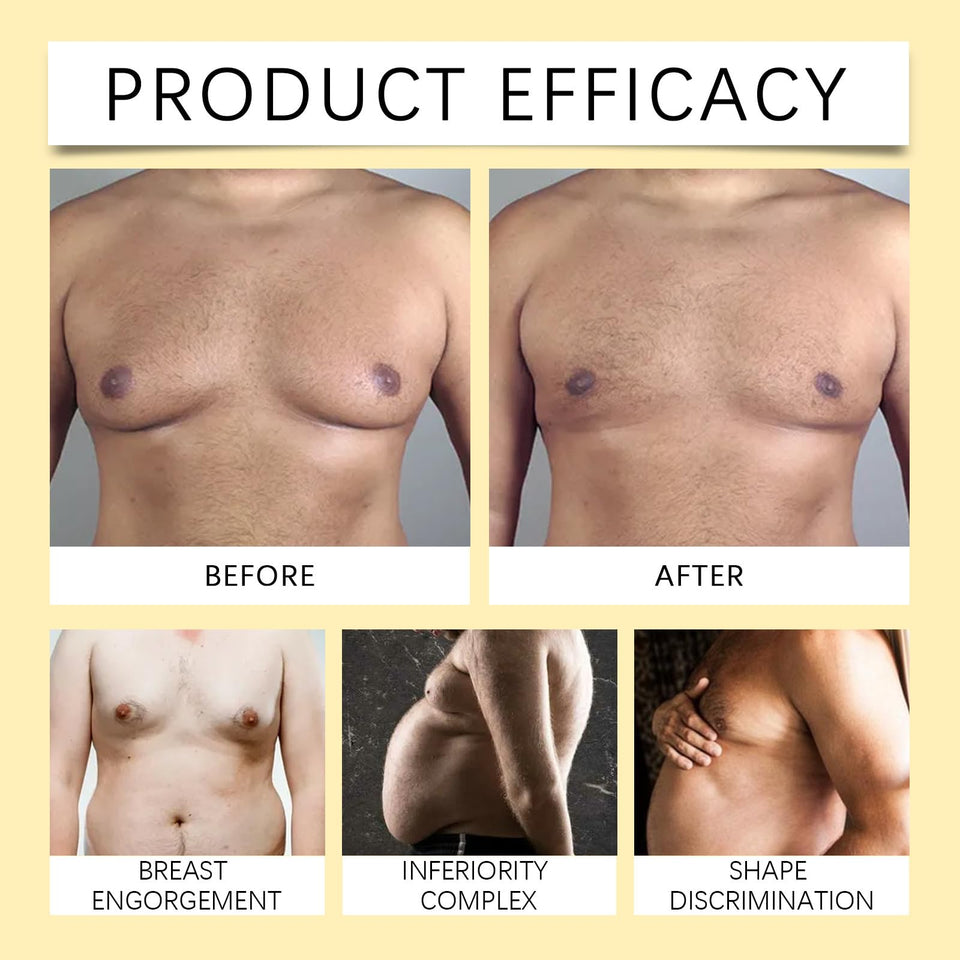Bee Venom Gynecomastia  Oil
